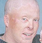 Lead photo